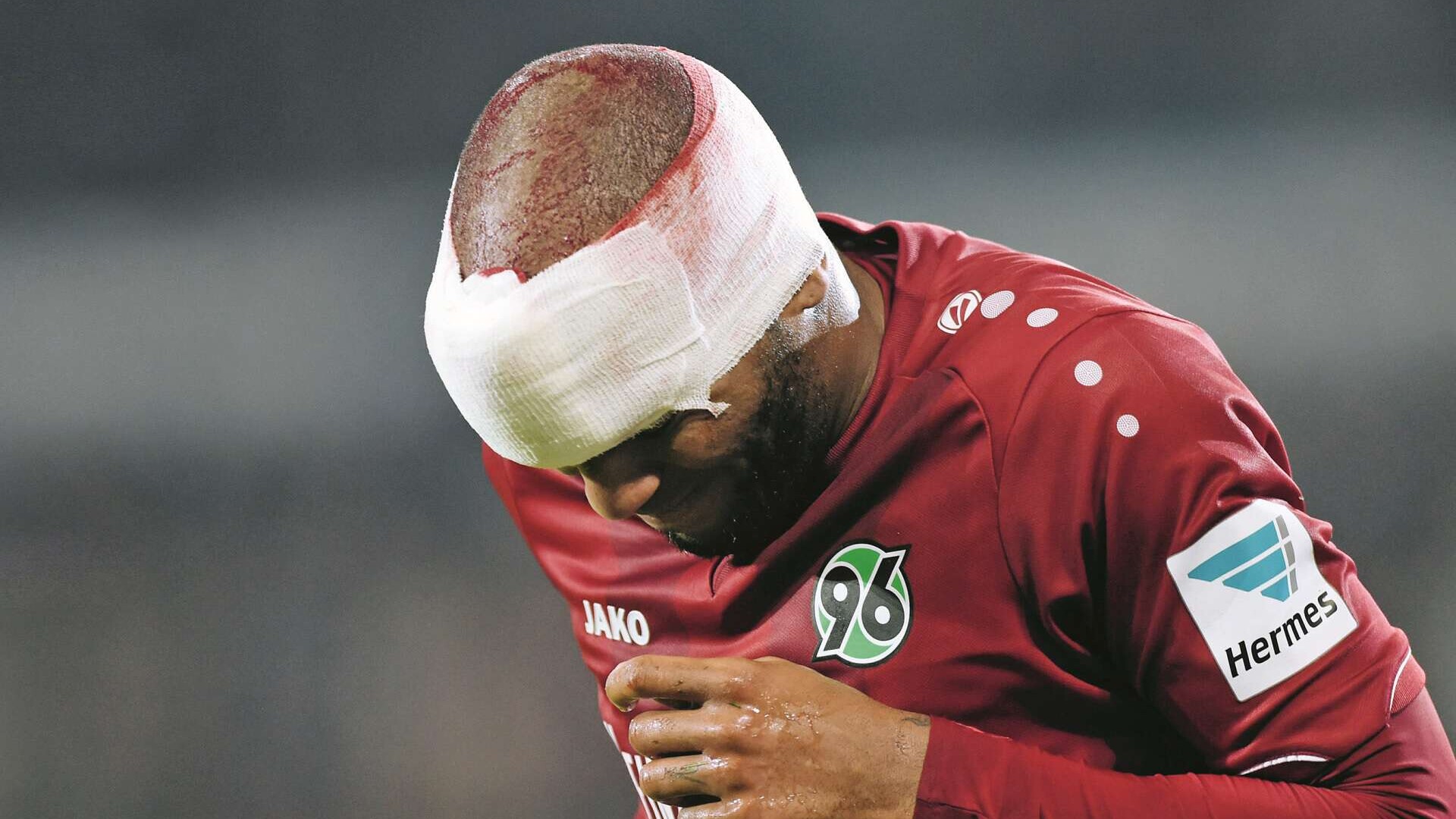 Am Kopf verletzter Fußballspieler mit Verband, 

Kopfverletzung Jimmy Briand, Fußball Bundesliga, Hannover 96 - Eintracht Frankfurt